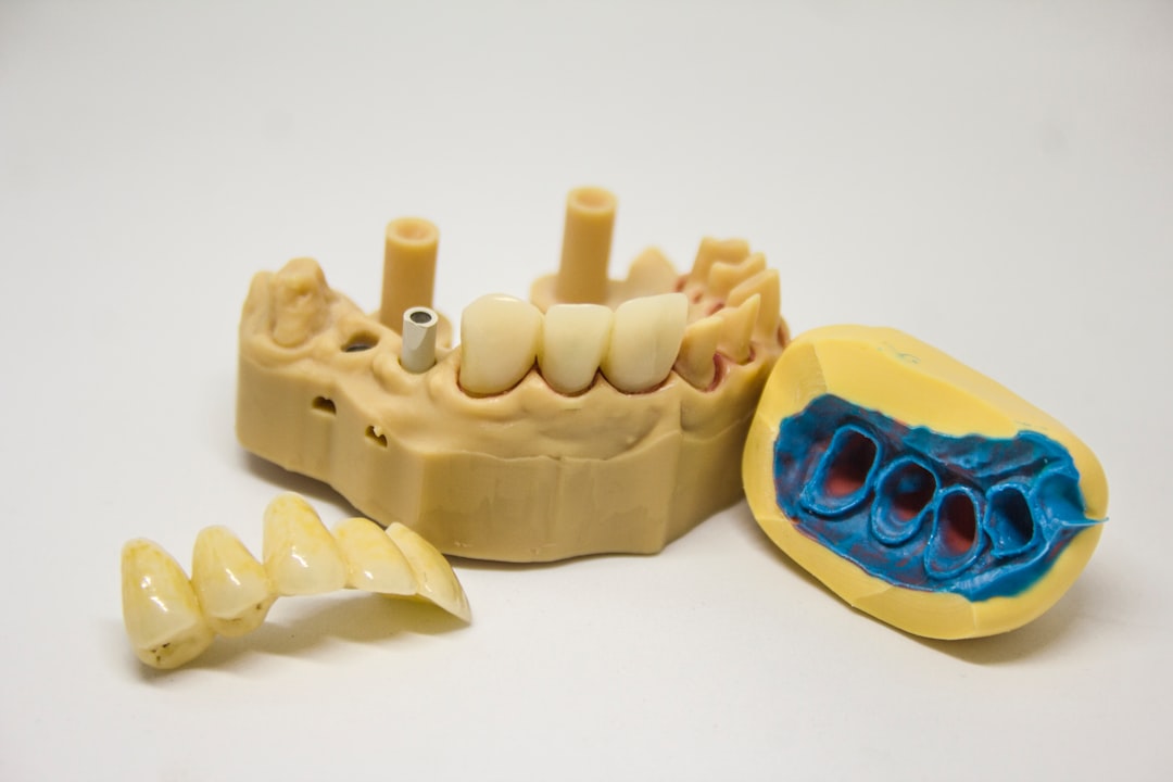 Photo Dental implants